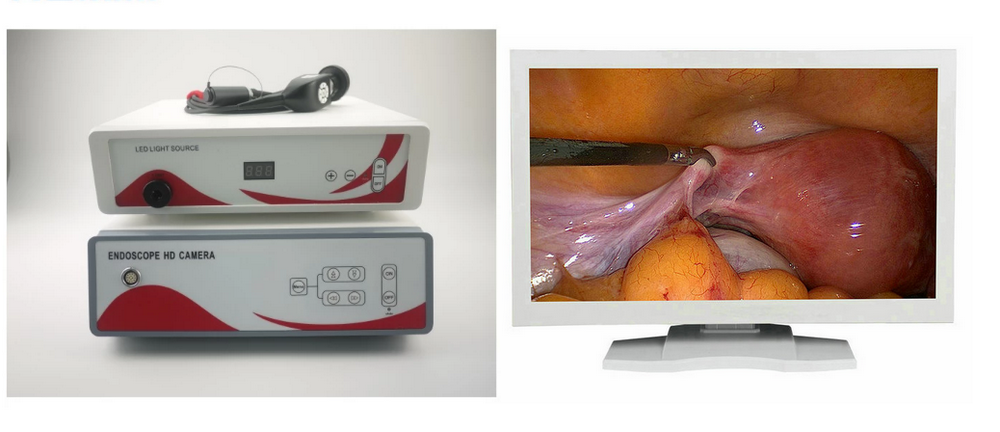 1080p FHD ENT laparoscopy medical endoscope camera (3)
