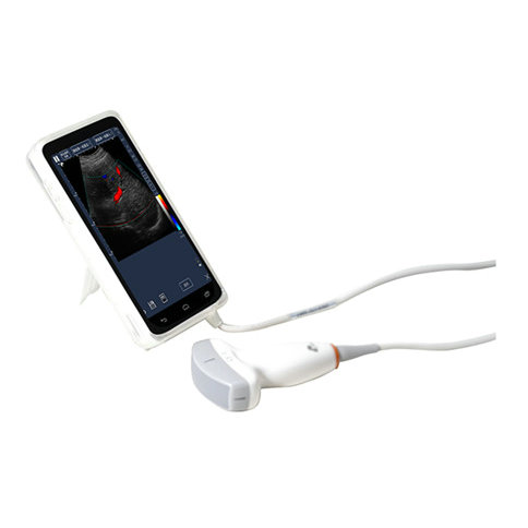 128-Elements-USG-USB-Convex-Ultrasound-Probe-With-Phone