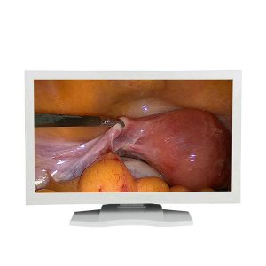 24 inch medical endoscopic monitor for endoscopy (3)