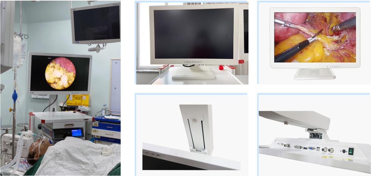 24 inch 27 inch medical endoscopic monitor for endoscopy