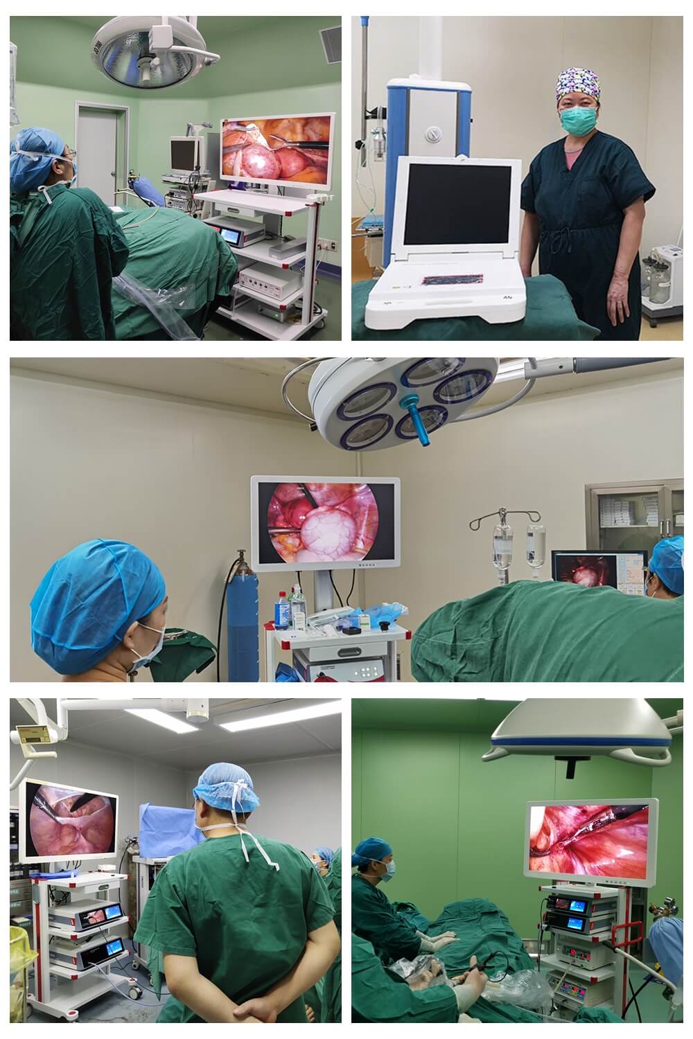 17 Inch HD Portable HD Endoscope Camera For ENT Laparoscopy (1)