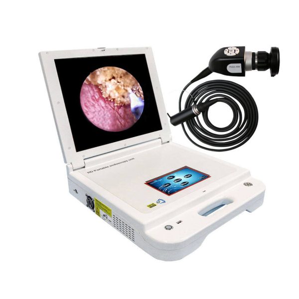 17 Inch HD Portable HD Endoscope Camera For ENT Laparoscopy (3)