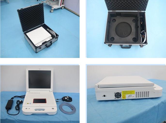 17 Inch HD Portable HD Endoscope Camera For ENT Laparoscopy (1)