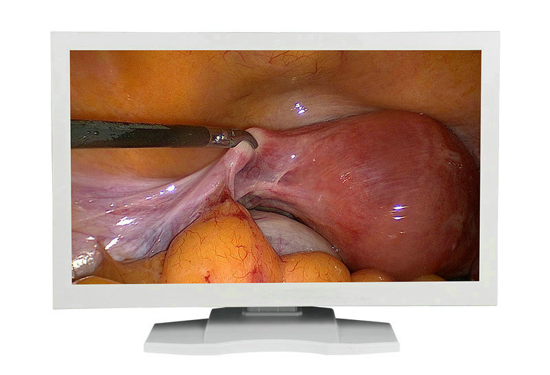 24 inch 27 inch medical endoscopic monitor for endoscopy