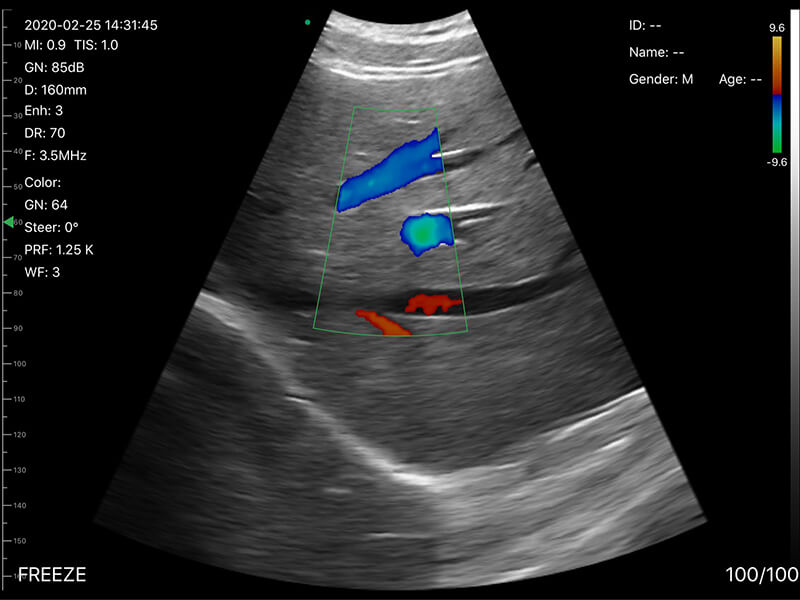 Convex linear cardiac 3 in 1 wifi doppler ultrasound probe 5CPL