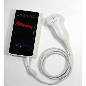 128-Elements-USG-USB-Convex-Ultrasound-Probe-With-Phone