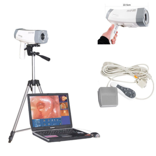 Portable Handheld Gynecology Digital Video Colposcope PL-9800 (4)